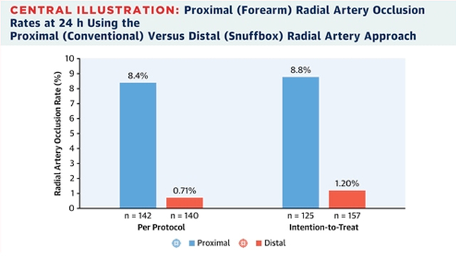 Distal radial artery approach to prevent radial artery occlusion trial