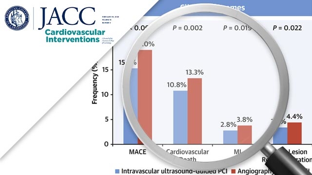 Impact of intravascular ultrasound on long-term clinical outcomes in patients with acute myocardial infarction