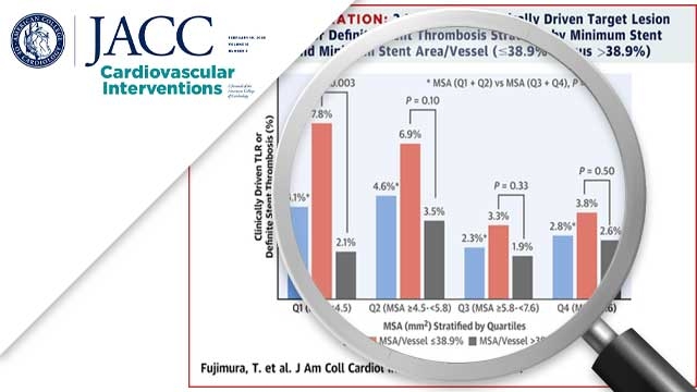 Stent expansion indexes to predict clinical outcomes: an IVUS substudy from ADAPT-DES