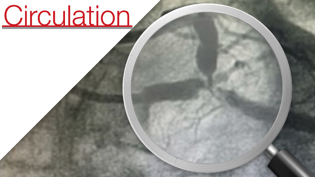 Impact of kissing balloon in patients treated with ultrathin stents for left main lesions and bifurcations: an analysis from the RAIN-CARDIOGROUP VII study