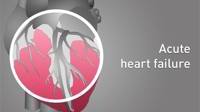 Acute heart failure