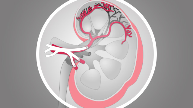 Interventions for Hypertension