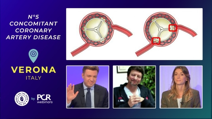 #5 - A patient with aortic stenosis - how should we treat the coronary disease?