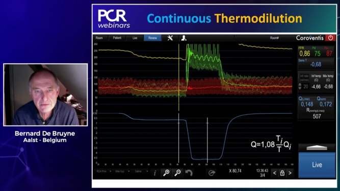 Closing the loop of coronary physiology: from FFR to MRR