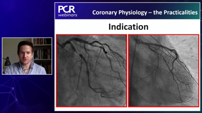 Coronary physiology in a modern catheter laboratory