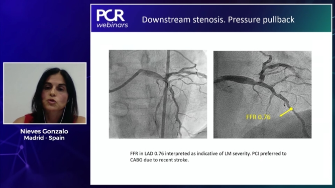 How to use Invasive Coronary Physiology to assess LM disease, pre-TAVI and pre-CABG interventions?