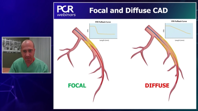 PPG: a novel dimension in coronary physiology