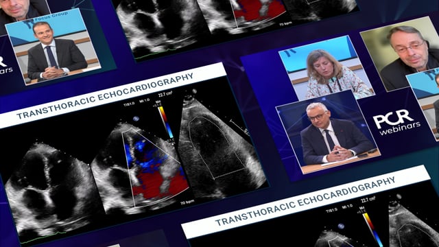 How will the new valvular guidelines impact my tricuspid programme?