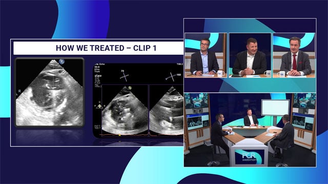 Lead management during tricuspid interventions