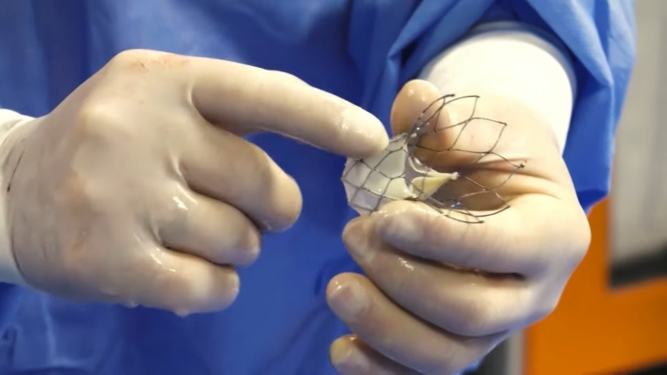 How do I ensure long valve durability for my TAVI patients?