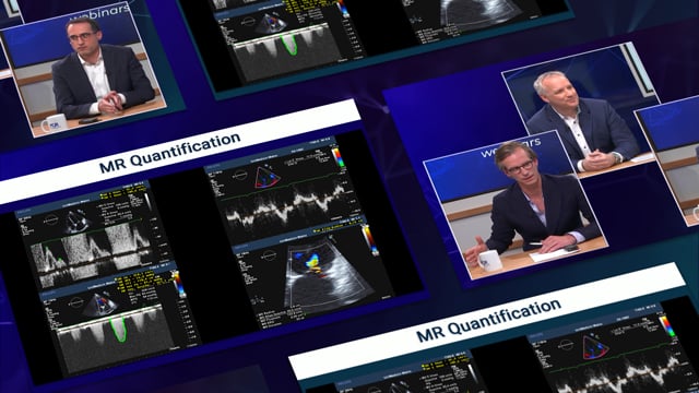 Mitral interventions: translating the new guidelines into practice