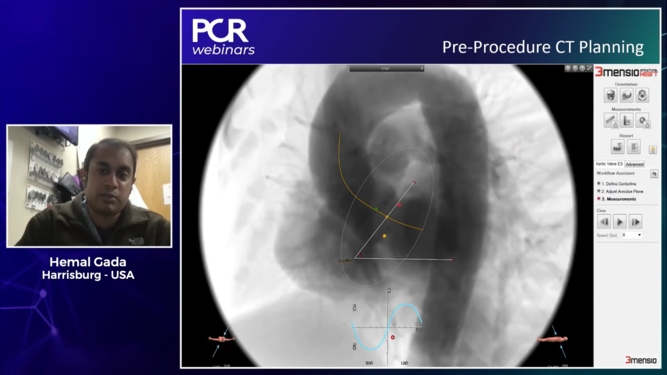 TAVI: How can procedural and device refinements benefit our patients?