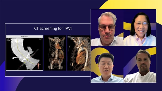 Overcoming complexity in TAVI: a patient-centered approach