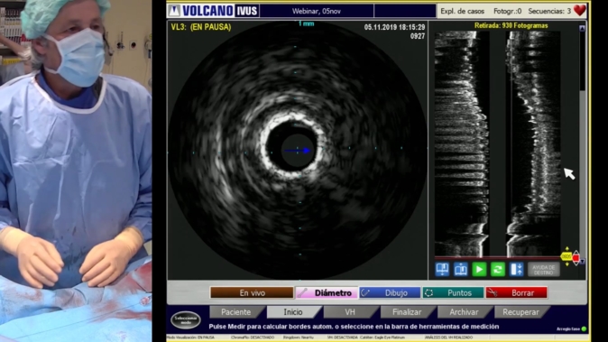 How physiology can guide you in LM PCI?