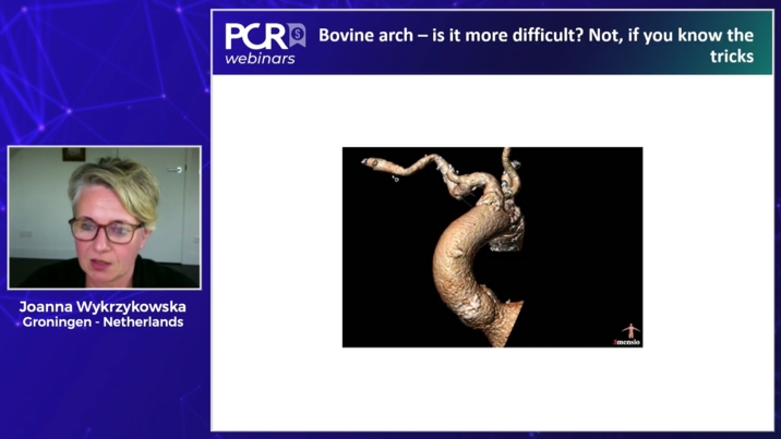 PROTECTED TAVR – Impact on Clinical Practice