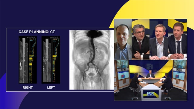 Revisiting aortic valve replacement in light of the new ESC/EACTS guidelines
