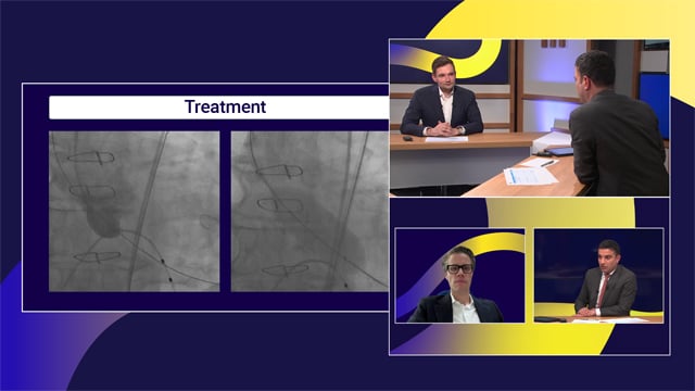 TAVI Durability: Evidence and contemporary practice
