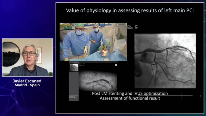 How should I optimise treatment of LM disease using intracoronary guidance?