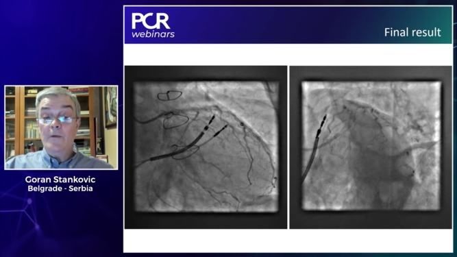 How should I treat a patient with LM disease: lessons from the EBC Main trial