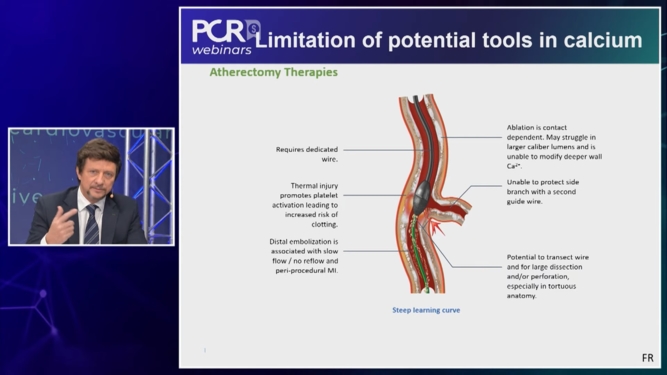 The Consistency of Coronary IVL Across Calcium Types, Genders and Over Time