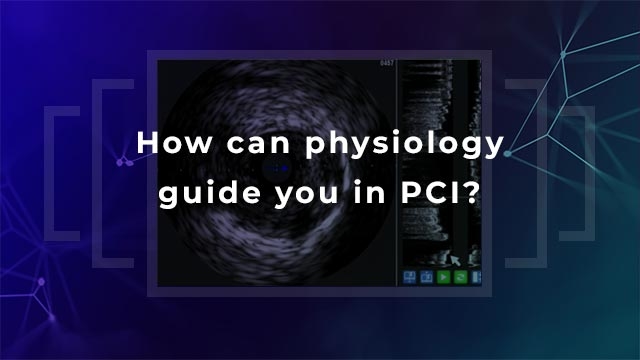 How can physiology guide you in PCI?