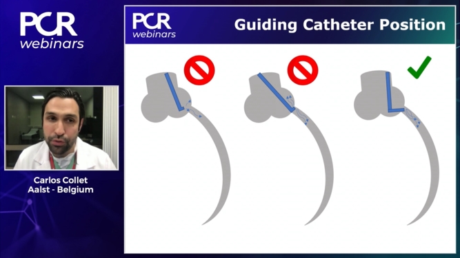 Interventional functional procedures in INOCA
