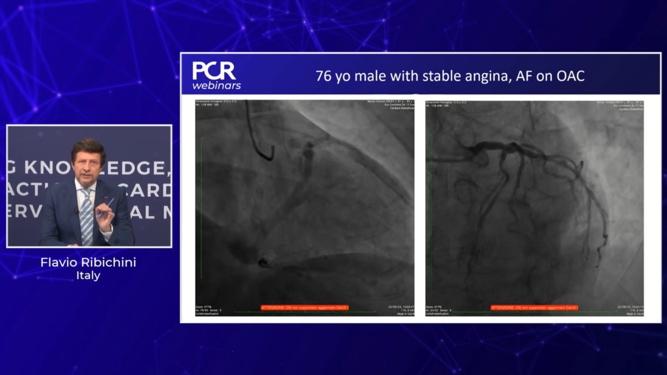 Treating patients with drug-coated balloons – what is the optimal result?