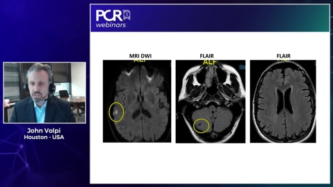 PFO closure in 2021 – Ground-breaking 5-year outcomes from the REDUCE clinical study