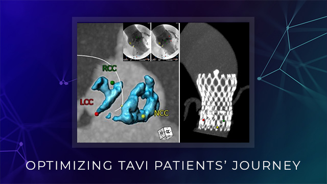 Optimising TAVI patients’ journey
