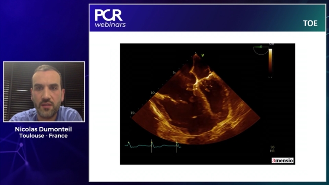 Complex mitral and tricuspid intervention - the PCR Valves e-Course revisited