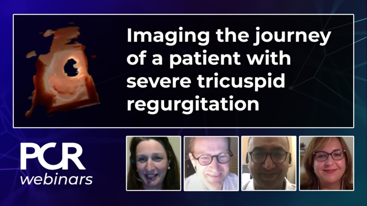 Imaging the journey of a patient with severe tricuspid regurgitation: from diagnosis to management