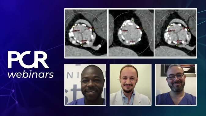 How should I treat my TAVI patients today and ensure future coronary access?