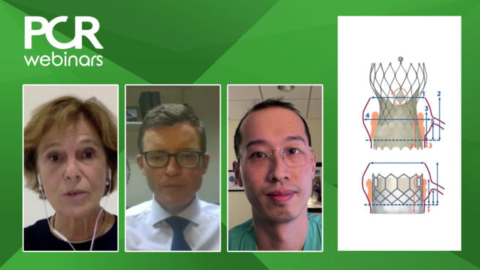 How can we optimise coronary access after TAVI?