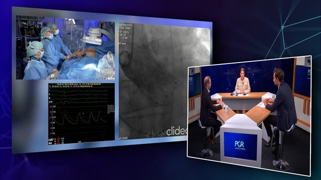 How to approach the challenges of large annuli in TAVI