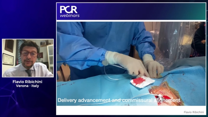 How to ensure coronary access after transcatheter aortic valve implantation?