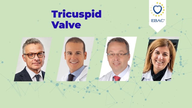 How will the new valvular guidelines impact my tricuspid programme?