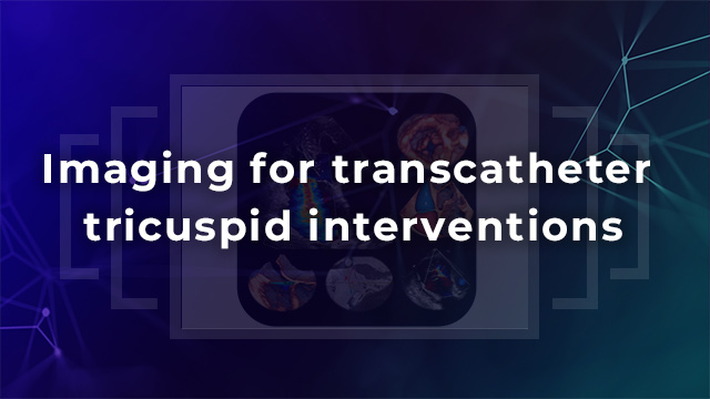 Imaging for transcatheter tricuspid interventions