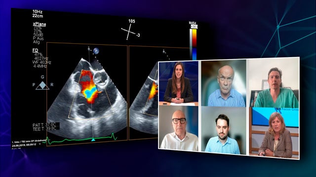 Tricuspid regurgitation and heart failure with preserved ejection fraction