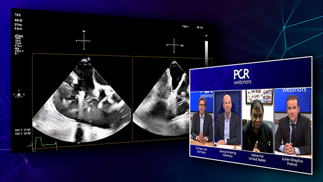 Updates in tricuspid interventions: from the procedure to follow-up